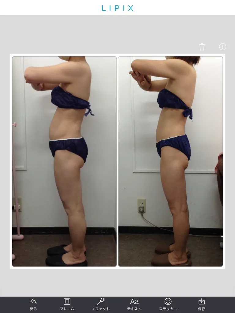 ビフォーアフター