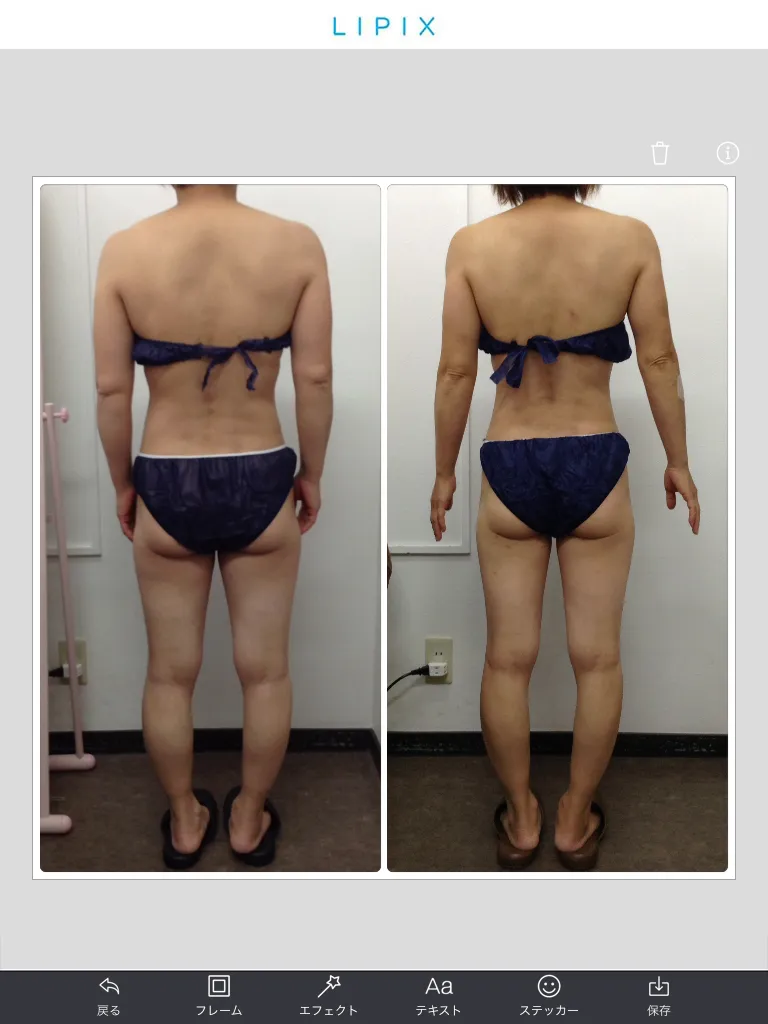 ビフォーアフター