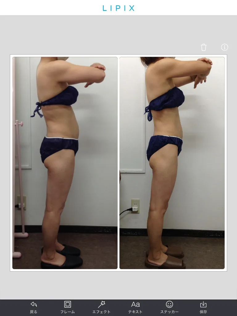 ビフォーアフター