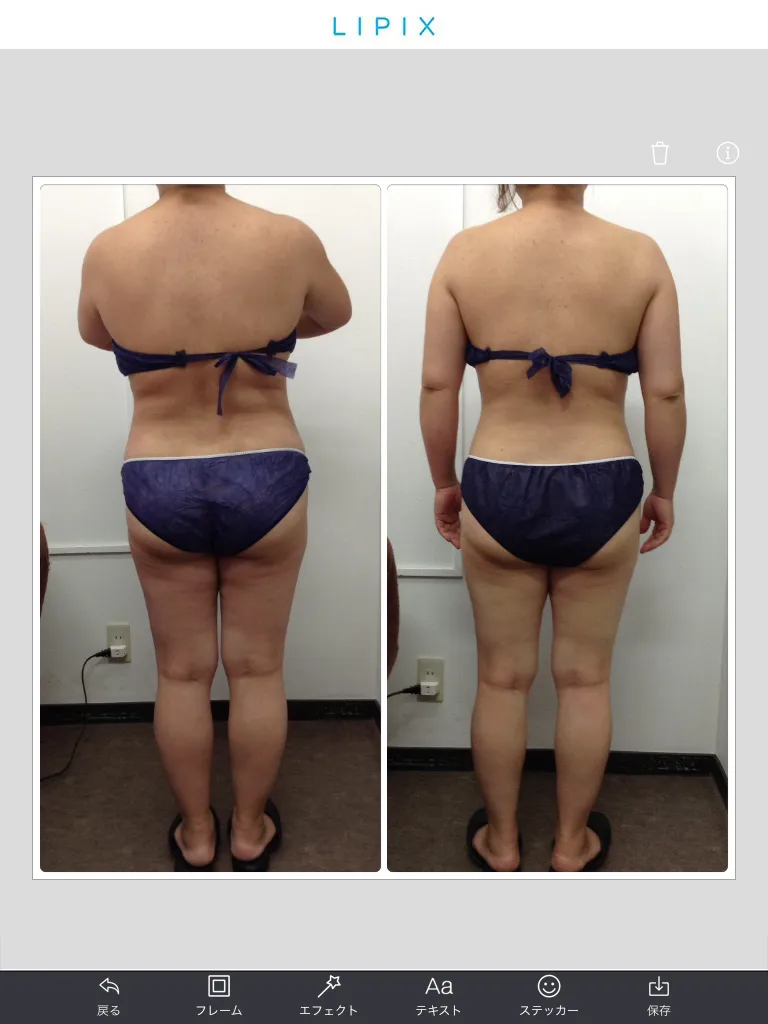 東海市・蟹江町で痩せたい方!結果重視の痩身エステの選び方。